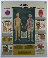 AIDS anatomical chart